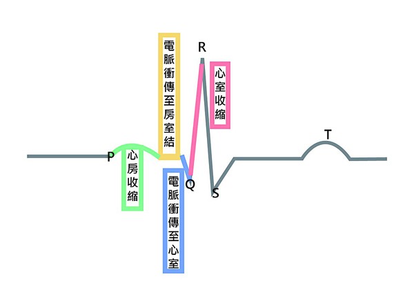 图4 : 此为心电图，心脏去极化运作顺序。(绘图／林彦伶)