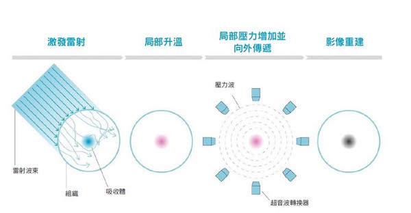 图二 : 运用光声原理，当光波撞击组织时，吸收光的分子会因为热能而膨胀松弛，这些振动会产生压力波，进而受到侦测并重建成医疗影像。