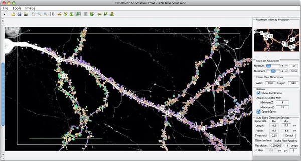 圖1 : 基於MATLAB的Spine Tool，用來將樹突棘的偵測、註記和分析自動化。