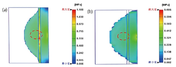 图2 : Von Mises应力分布 (a) 白斑严重组别 (b) 白斑轻微组别