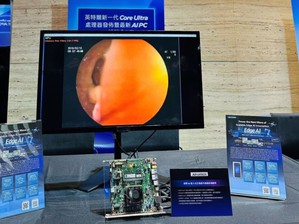 图一 : 研华工业级主机板锁定医疗内视镜影像应用， 采用 IntelR Core? Ultra Series 3 平台