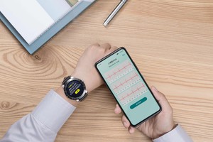 華碩VivoWatch智慧健康錶系列的ECG APP ，能夠建立、紀錄、儲存、傳送與顯示第一導程(Lead I)相似的單通道心電圖。